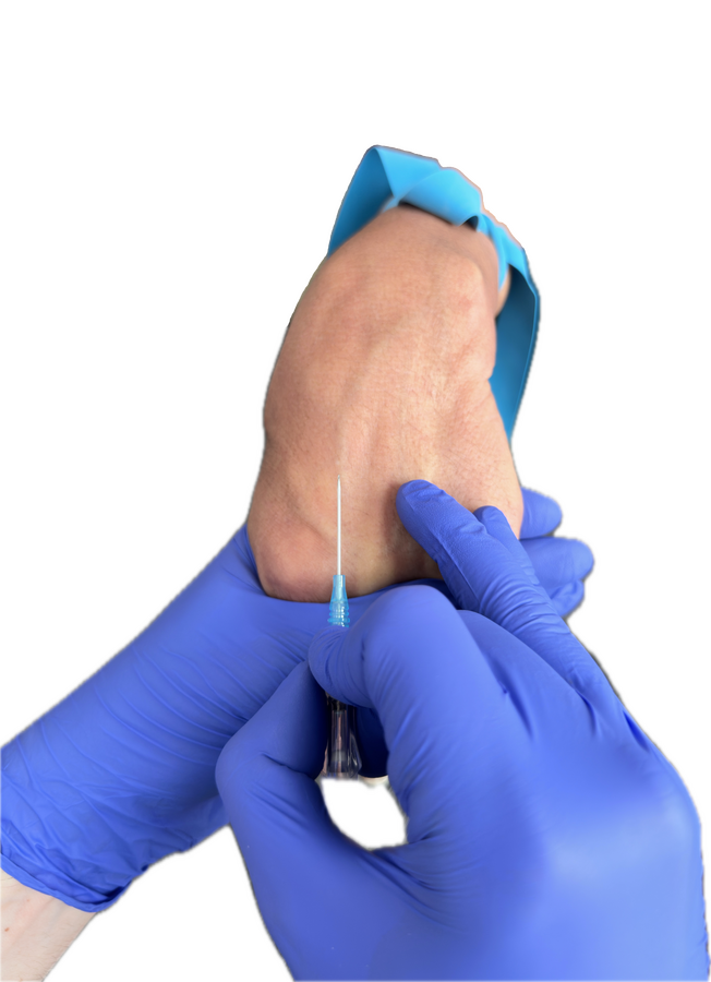 Engagement Grip with IV