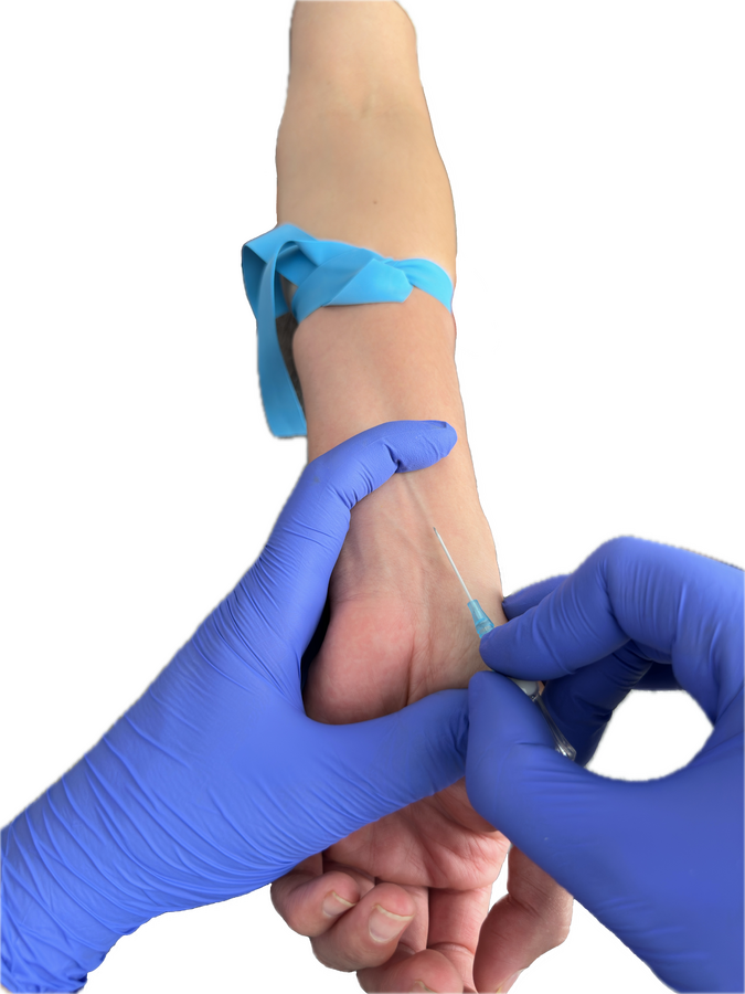 Anterior Wrist with IV