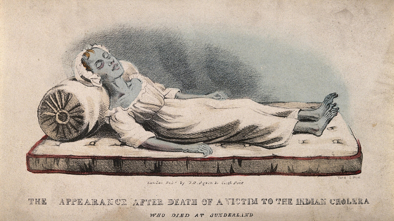 A Cholera Victim